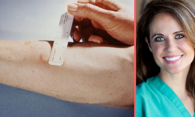 Dr. Paige Bundrick Offers A Free Skin Cancer Screening At The Fiest Weiller Cancer Center